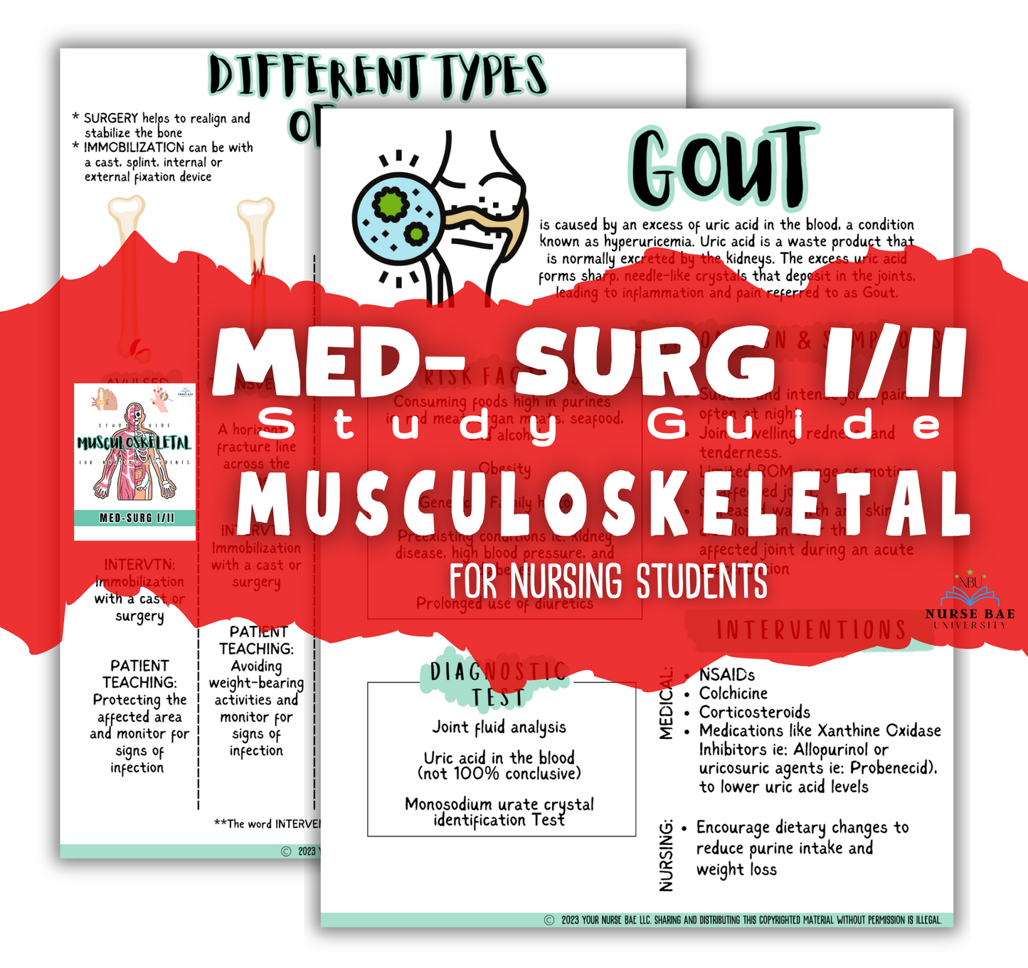 Musculoskeletal Study Guide - Med Surg I/II - Nursing Study Guide